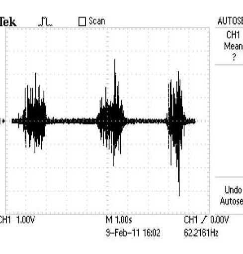 Safety Measures in Constructing EMG Amplifiers – Circuit Schematic